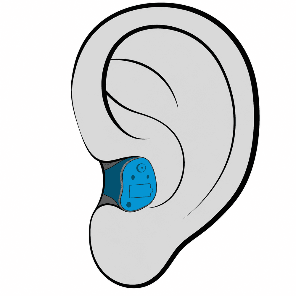 In-the-Canal (ITC) hearing aid style fitted at Advanced EARGEAR in Ohio