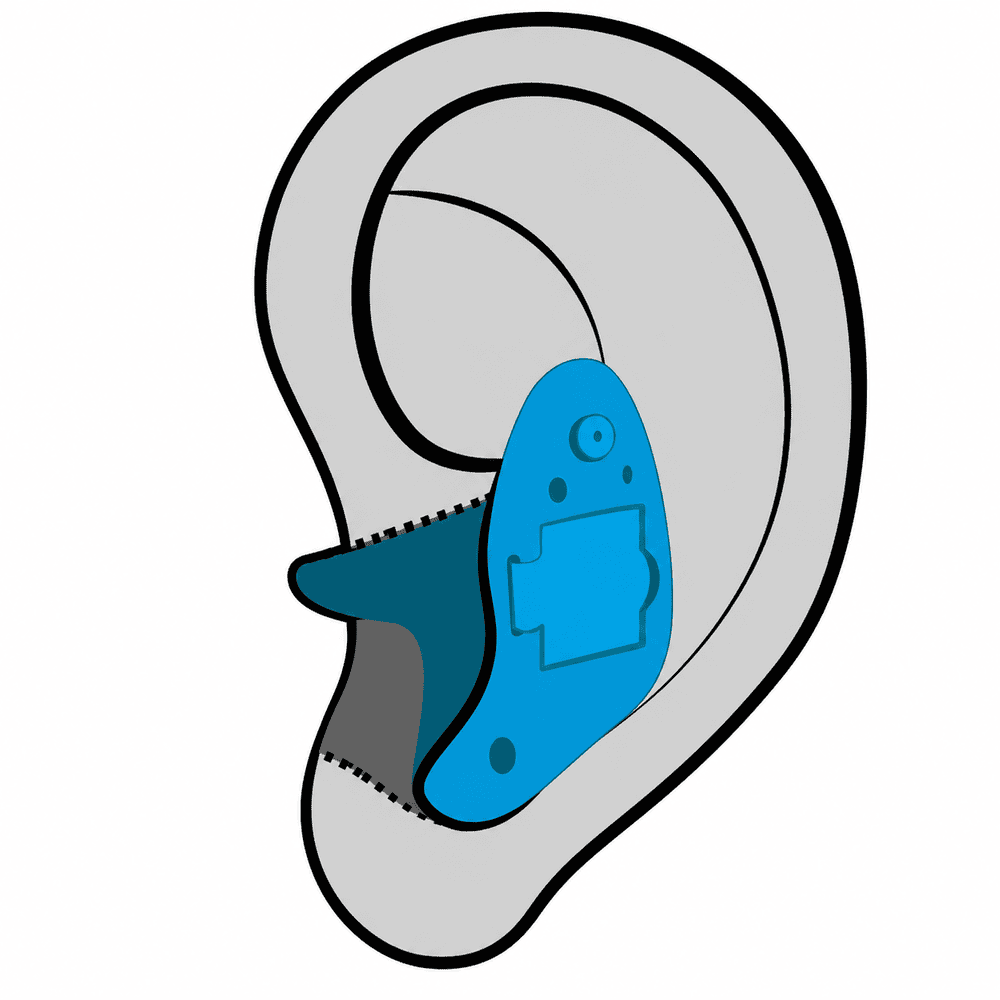In-the-Ear (ITE) hearing aid style fitted at Advanced EARGEAR in Ohio