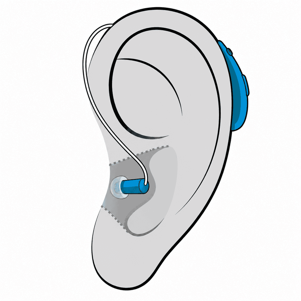 Receiver-in-Canal (RIC) hearing aid style fitted at Advanced EARGEAR in Ohio